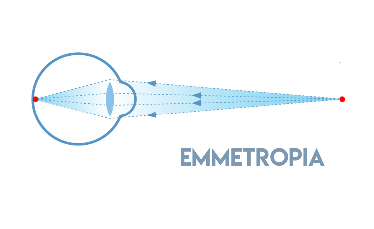 Czym jest emmetropia schemat